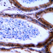 CPA1522-100ul - Granzyme B/H