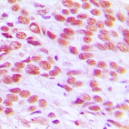 CPA1524-100ul - Histone H2A.x