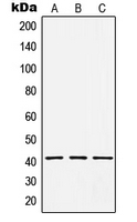 CPA1526-100ul - HCCS / CCHL