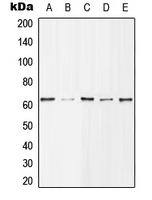 CPA1527-100ul - HDAC1