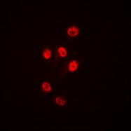 CPA1528-100ul - HDAC1