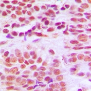 CPA1528-100ul - HDAC1