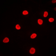 CPA1536-100ul - hnRNP-F / HNRNPF