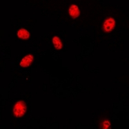 CPA1540-100ul - HOXA11/D11