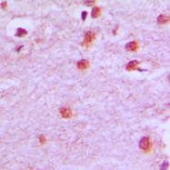 CPA1540-100ul - HOXA11/D11