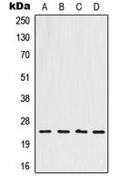 CPA1544-100ul - HOXB7 / HOX2C