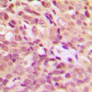 CPA1557-100ul - HSPB1 / HSP27