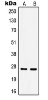 CPA1557-100ul - HSPB1 / HSP27
