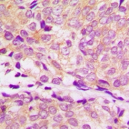 CPA1558-100ul - HSP90AA1 / HSP90 alpha