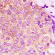 CPA1559-100ul - HSP60
