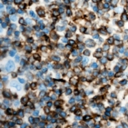 CPA1575-100ul - IFNG / Interferon gamma