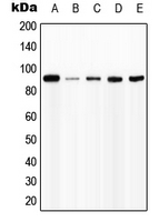 CPA1576-100ul - CD119 / IFNGR1