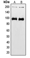 CPA1578-100ul - CD221 / IGF1R