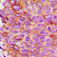 CPA1593-100ul - Interleukin-5 / IL5