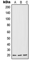 CPA1595-100ul - Interleukin-7 / IL7