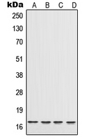 CPA1598-100ul - Interleukin-17A (IL17A)