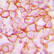 CPA1617-100ul - CD61 / ITGB3