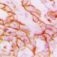 CPA1618-100ul - CD61 / ITGB3