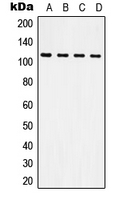 CPA1618-100ul - CD61 / ITGB3