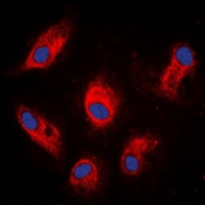 CPA1624-100ul - Involucrin / IVL
