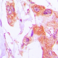 CPA1624-100ul - Involucrin / IVL
