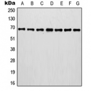 CPA1624-100ul - Involucrin / IVL