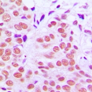 CPA1631-100ul - AP-1 / c-Jun