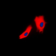 CPA1638-100ul - Junction plakoglobin
