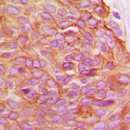 CPA1638-100ul - Junction plakoglobin
