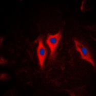 CPA1656-100ul - Cytokeratin 5