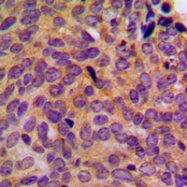 CPA1656-100ul - Cytokeratin 5