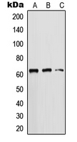 CPA1656-100ul - Cytokeratin 5
