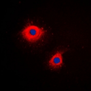 CPA1657-100ul - Cytokeratin 7