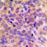 CPA1657-100ul - Cytokeratin 7