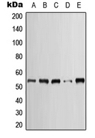 CPA1657-100ul - Cytokeratin 7