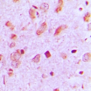 CPA1661-100ul - Cytokeratin 13