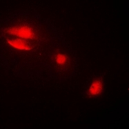 CPA1662-100ul - Cytokeratin 14