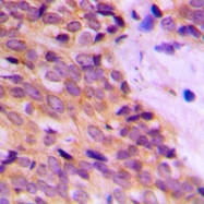 CPA1662-100ul - Cytokeratin 14