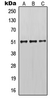CPA1662-100ul - Cytokeratin 14