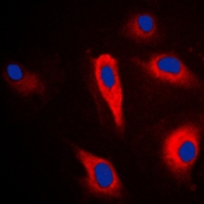 CPA1663-100ul - Cytokeratin 16