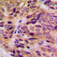 CPA1663-100ul - Cytokeratin 16