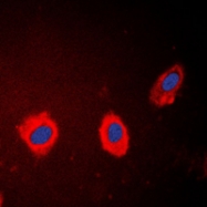 CPA1664-100ul - Cytokeratin 17