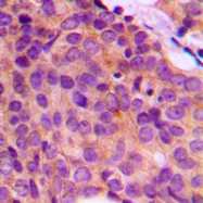 CPA1664-100ul - Cytokeratin 17
