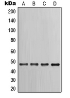 CPA1664-100ul - Cytokeratin 17