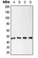 CPA1665-100ul - Cytokeratin 18