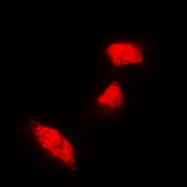 CPA1666-100ul - Cytokeratin 18