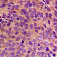 CPA1666-100ul - Cytokeratin 18