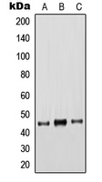 CPA1666-100ul - Cytokeratin 18
