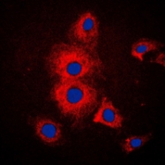 CPA1667-100ul - Cytokeratin 19