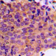 CPA1667-100ul - Cytokeratin 19